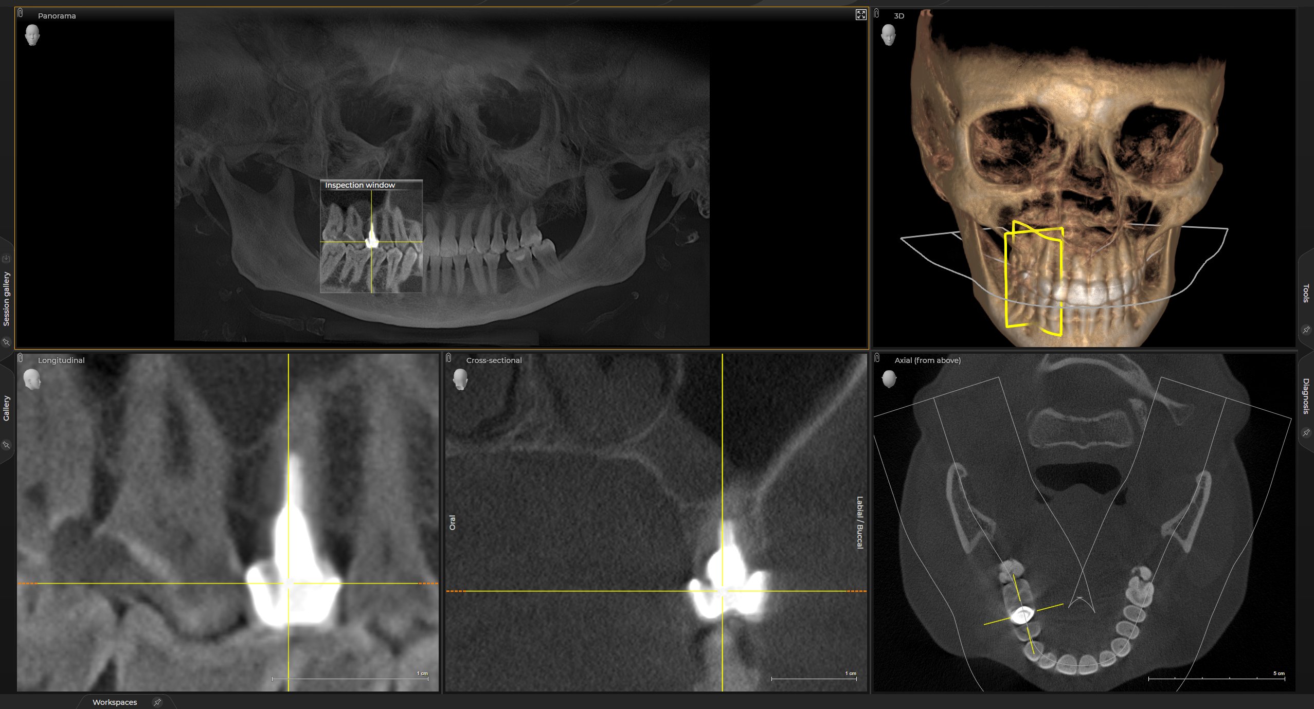 Sidexis 4 Cross-Sectional View